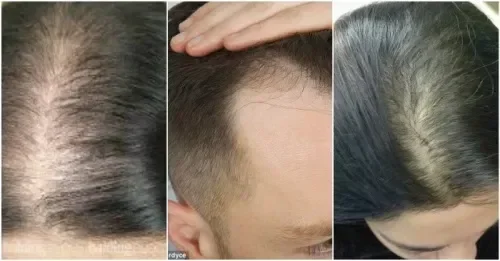 Vihair Azərbaycan - qiymət - rəylər - bu nədir - harada almaq - nəticə - aptek - sifariş.